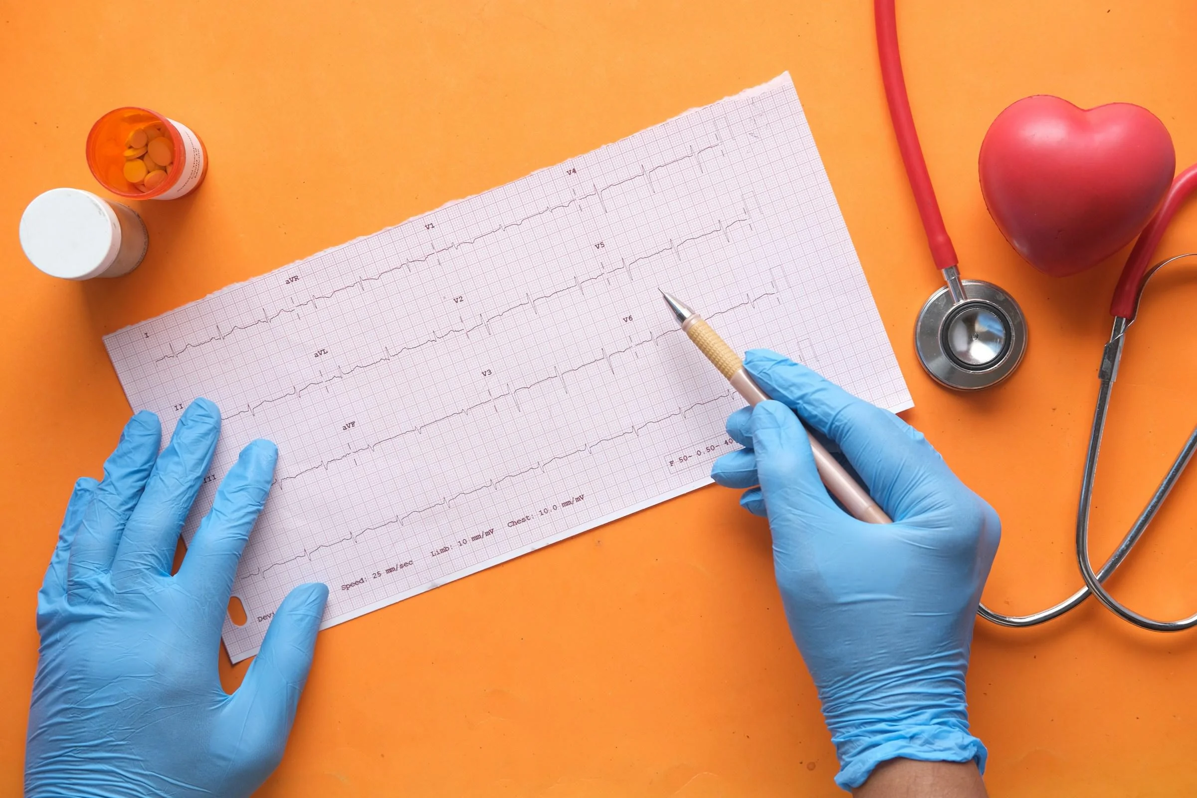 heart doctor