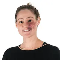 Hillary Vipond
